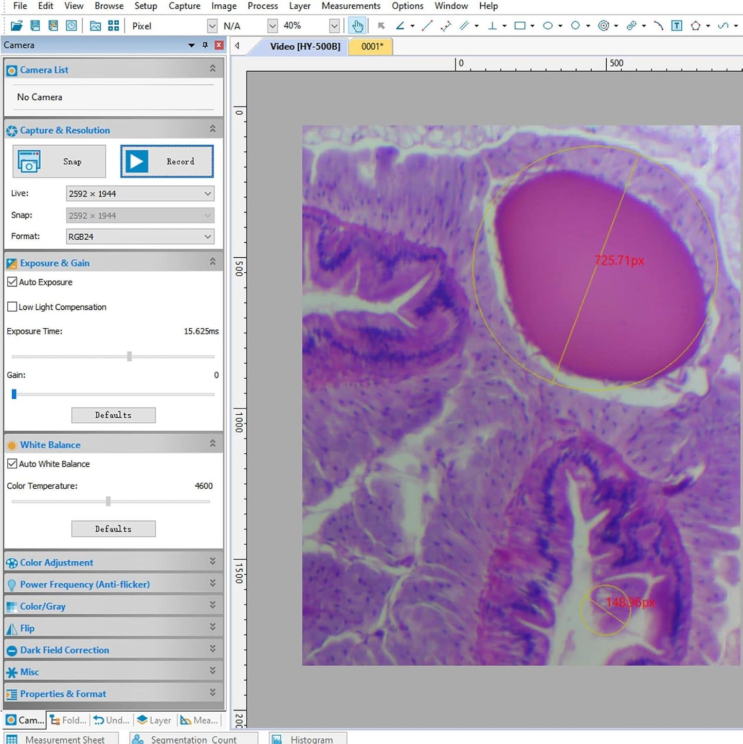 [5MP] Vabiooth USB 2.0 Digital Camera captures Still Images, Streams Live Videos, and is Compatible with WIN7/8/10/SP4/XP/VISTA, Mac, Linux
